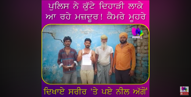 ਪੁਲਿਸ ਨੇ ਕੱੁ-ਟੇ ਦਿਹਾੜੀ ਲਾਕੇ ਆ ਰਹੇ ਮਜ਼ਦੂਰ!ਕੈਮਰੇ ਮੂਹਰੇ ਦਿਖਾਏ ਸਰੀਰ ‘ਤੇ ਪਏ ਨੀਲ